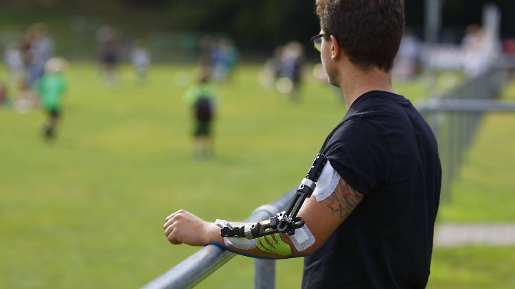 Profis lassen sich schnell gesund spritzen. Doch bei Freizeitsportlern ist die Saison nach einem Unfall oft gelaufen. Und wenn man Pech hat, heilen Schäden nie ganz aus.