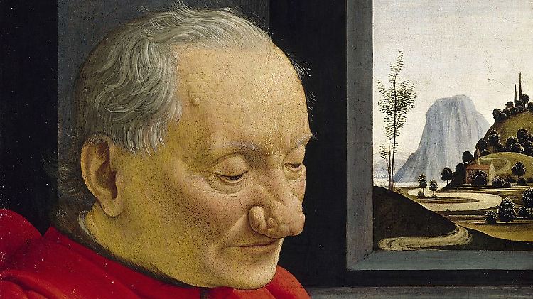 Das Bild von Domenico Ghirlandaio (1488) zeigt einen Großvater mit seinem Enkel.  Das Rhinophym des alten Mannes ist auf dem Bild nicht rot dargestellt.