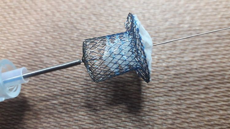 Ein im Zentrum des Kardiologen Franz Freudenthal hergestelltes Draht-Implantat, das hier von Frauen gewebt wird.