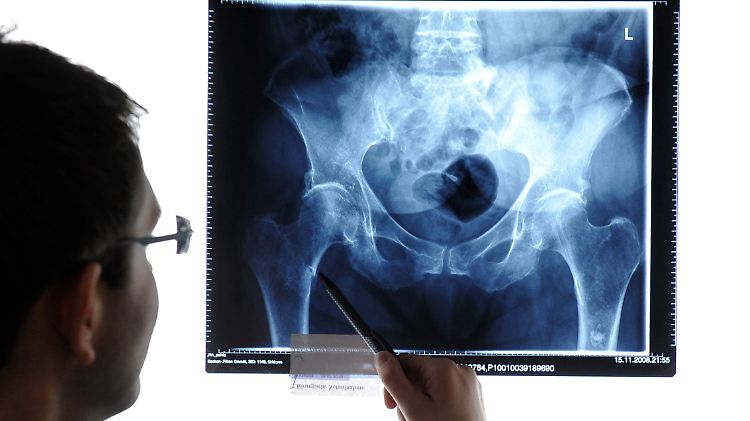 Radiologen haben die höchsten Reinerträge, allerdings werden Sozialabgaben und andere Aufwendungen nicht berücksichtigt.