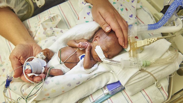 Frühchen sind besonders gefährdet. Sie können sich leicht mit dem Hefepilz Candida auris infizieren. 