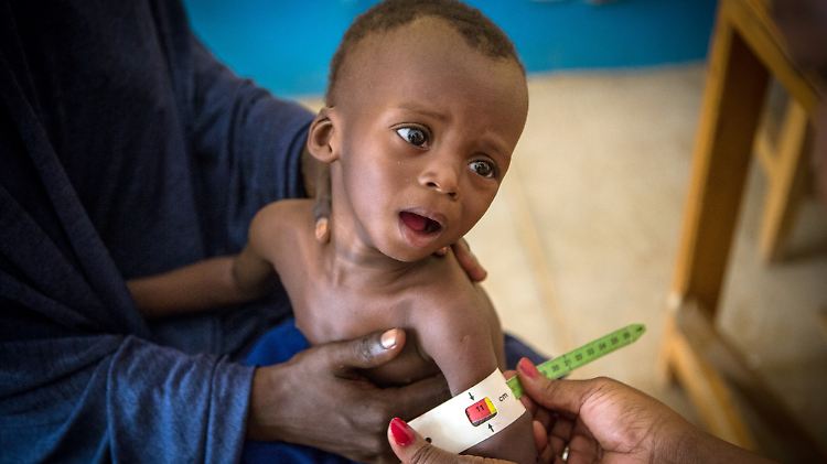 Voraussichtlich 165.000 Kinder werden 2018 in Mali an lebensbedrohlicher Mangelernährung leiden.