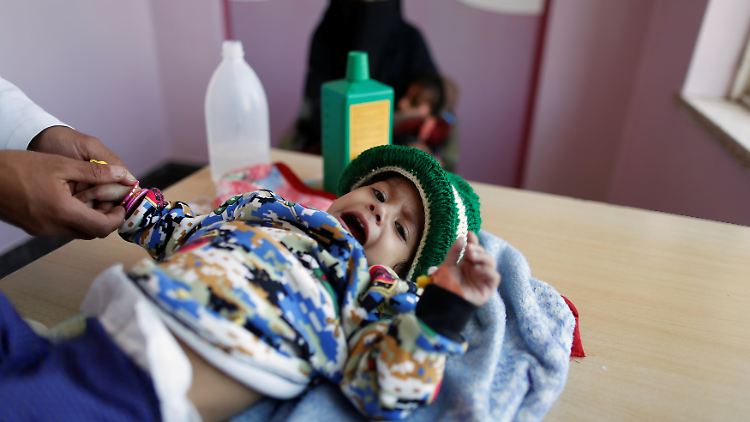 Ein Junge wird in Sanaa wegen Unterernährung medizinisch versorgt.