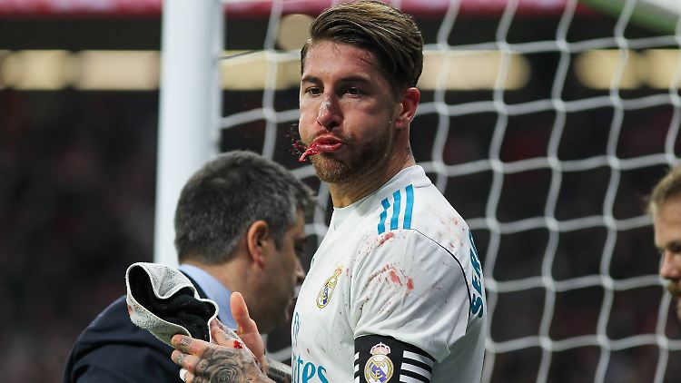 Für Sergio Ramos verlief der Abend doppelt bitter - kein Sieg, dafür aber eine lädierte Nase.
