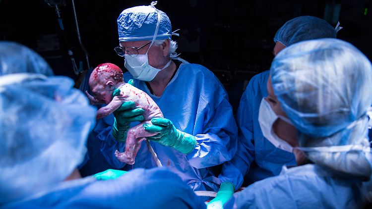Ärzte der Baylor-Universität entbinden einen Jungen nach einer Gebärmutter-Transplantation.