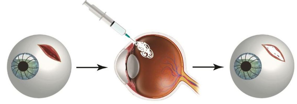 Auge.jpg