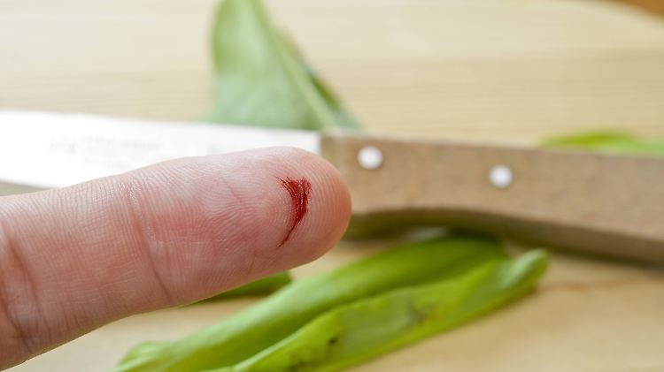 Für Menschen mit einer Blutphobie reicht ein kleiner Schnitt aus, um zu reagieren.
