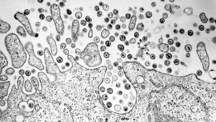 Elektronenmikroskopische Aufnahme des HI-Virus.