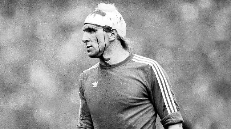 Dieter Hoeneß schwer gezeichnet beim DFB-Pokalfinale 1982.