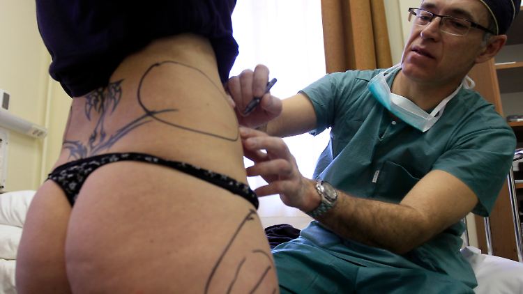 Vor einer Liposuktion zeichnet der Arzt die Bereiche an, wo Fett abgesaugt werden soll.