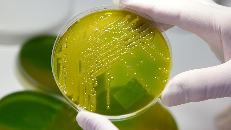 Auch der sogenannte EHEC-Keim, der hier in einer Petrischale wächst, wird zu den multiresistenten Keimen gezählt. 