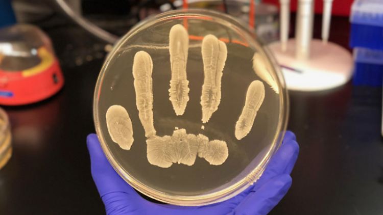 Ein Stamm des Bakteriums Staphylococcus epidermidis produziert ein Molekül, das Krebszellen abtötet und die Entwicklung von Hauttumoren bei Mäusen hemmt.
