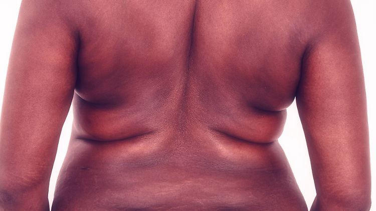 Unabhängig davon, ob man es schön findet oder nicht: Ein zu großer Taillenumfang ist ungesund.