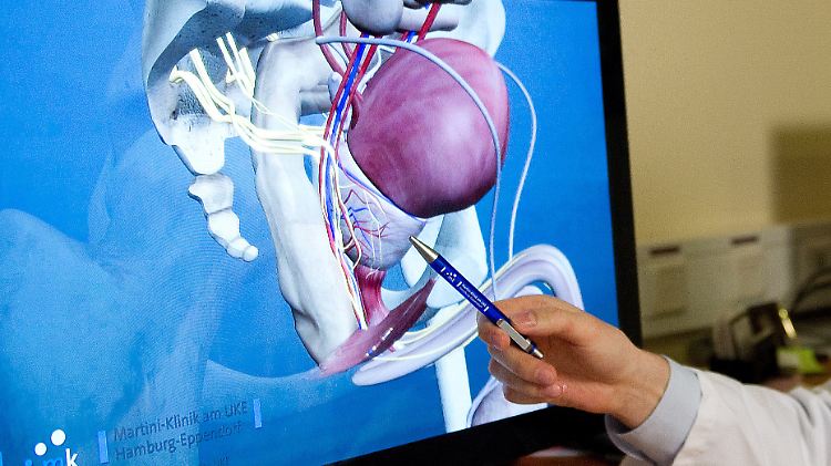 Die neue Operationsmethode sei ein "Meilenstein der Urologie", sagen Mediziner.
