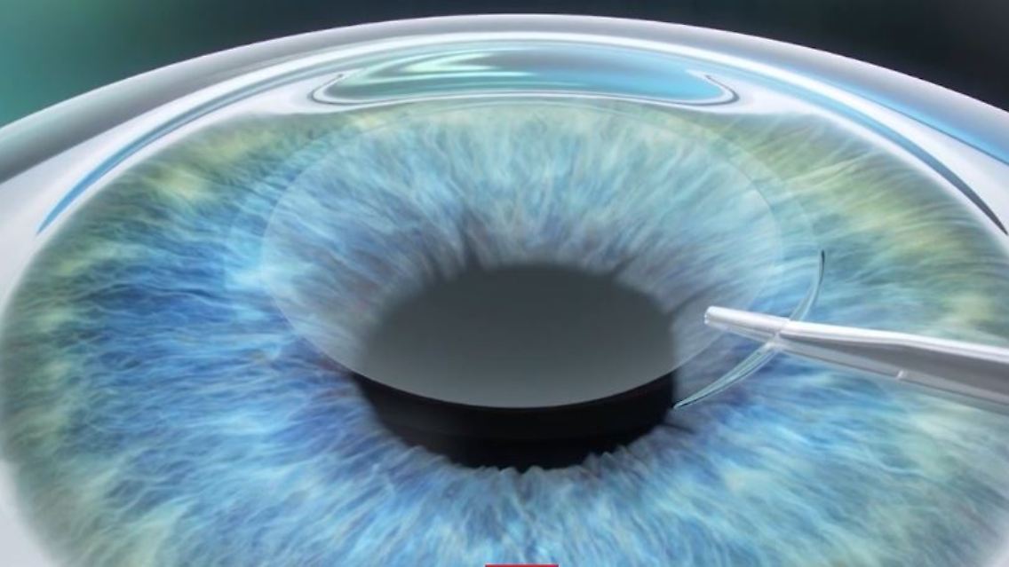 auge3.JPG