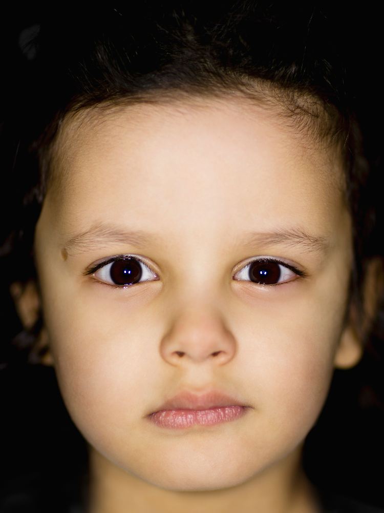Ein dreijähriges Mädchen: Bei den Kindern sind die Veränderungen "am dramatischsten".