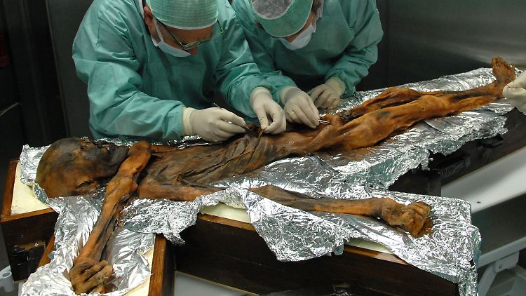 Forscher bei der Probenahme des Mageninhaltes der Mumie: Ötzi hat nach Ansicht vieler Forscher vor allem fettreich gegessen.
