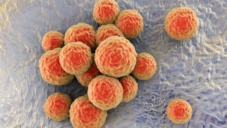 MRSA werden im Volksmund auch Krankenhauskeime genannt (Computergrafik).