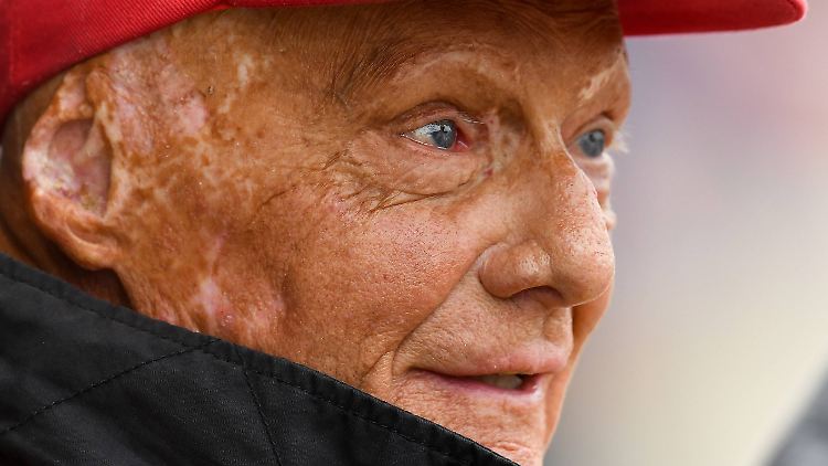 Niki Lauda geht's nach seiner Lungentransplantation besser.