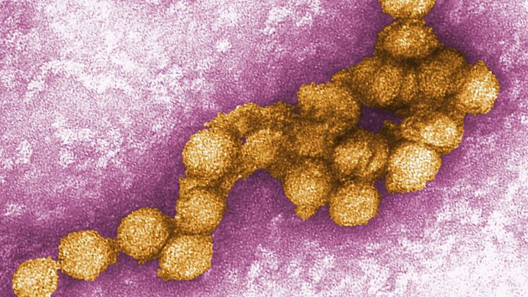 Das Virus unter dem Elektronenmikroskop.