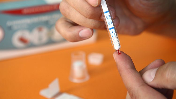 Mittlerweile sind HIV-Test so einfach zu handhaben, dass sie auch von Laien zu Hause durchgeführt werden können.