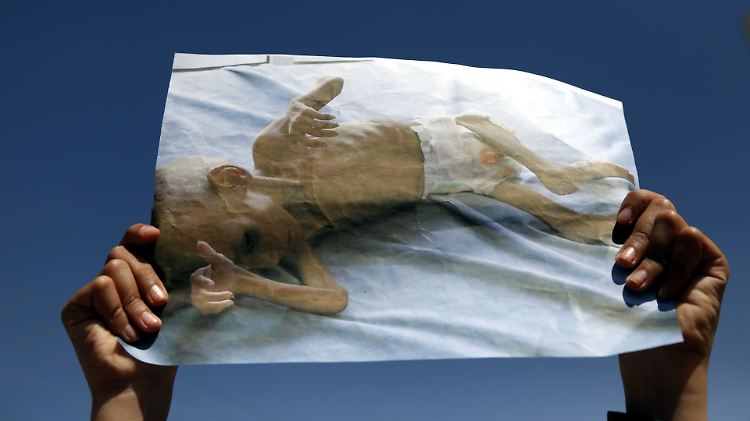 Ein jemenitischer Student hält während eines Protestes ein Bild eines unterernährten Kindes in die Höhe.