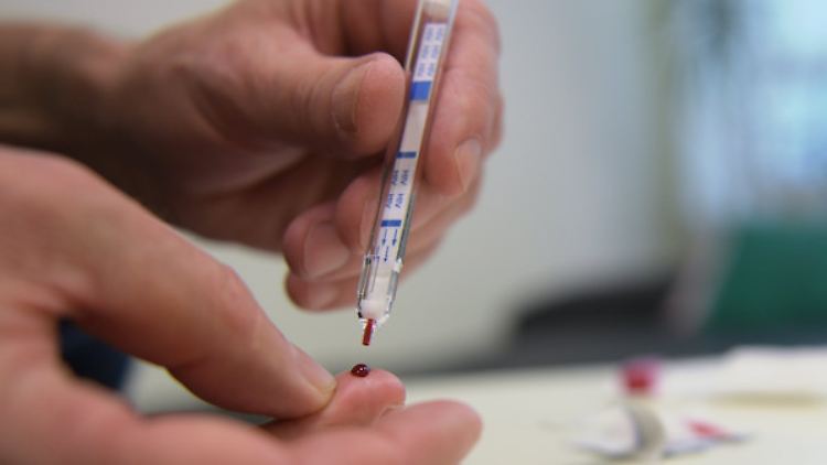 Ein junger Mann führt einen HIV-Selbsttest durch.