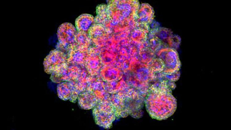 Mikroskopische Aufnahme eines Trophoblast-Organoids, das mit Cytokeratin 7, F-Actin und Dapi angefärbt wurde.