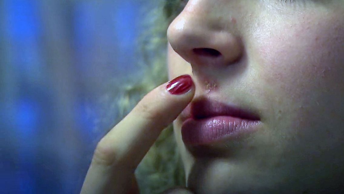 WissenHerpes.jpg