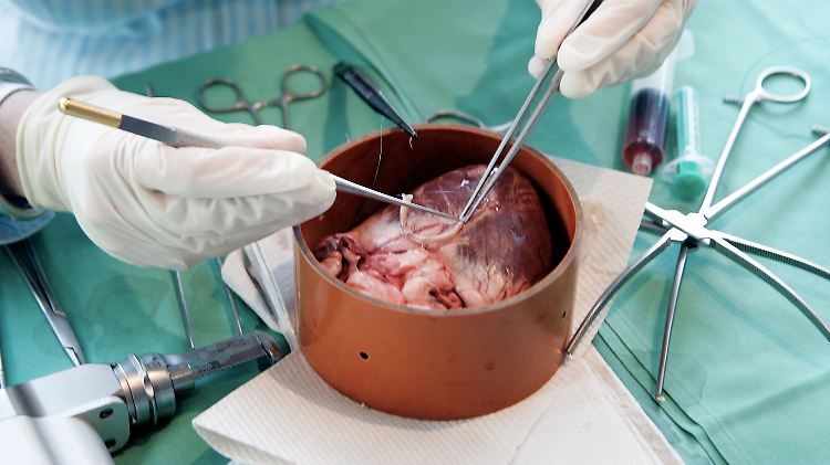 Die Schweineherzen mussten vor der Transplantation manipuliert werden. 