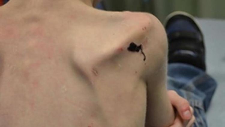 Bei seiner Befreiung wog der Fünfjährige nur noch 13 Kilogramm.