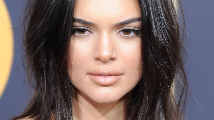 Kendall Jenner mit Pickeln auf dem roten Teppich der Golden Globes im vergangenen Jahr.