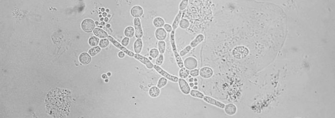 Candida_albicans_(sputum).jpg
