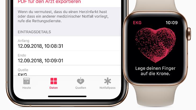 Die Apple Watch 4 kann jetzt auch in Deutschland ein EKG aufzeichnen.
