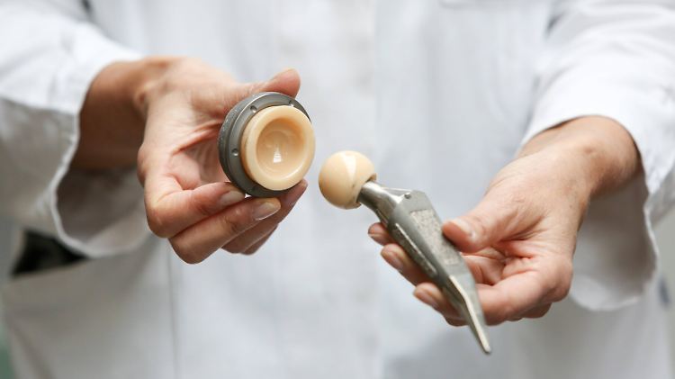 Ab 2021 sollen alle eingesetzten Implantate in einer zentralen Datei erfasst werden.