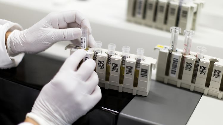 Blutproben der Studienteilnehmer werden regelmäßig im Labor auf das HI-Virus untersucht.
