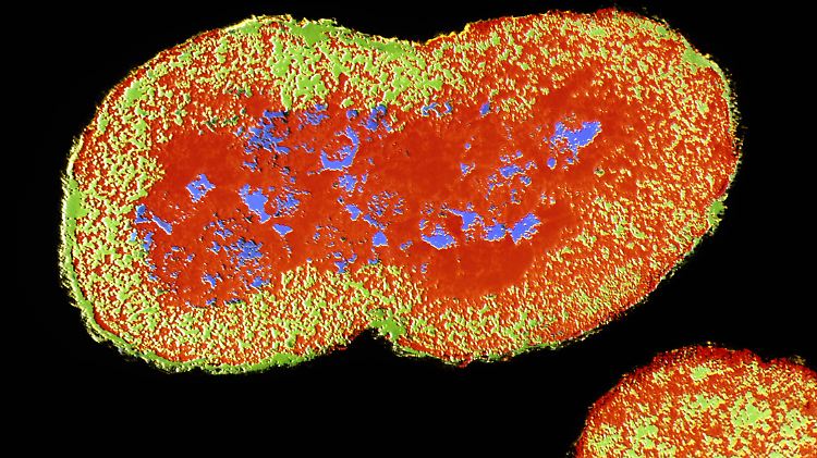 Ausgelöst wird Gonorrhö durch Bakterien der Art Neißeria gonorrhoeae.