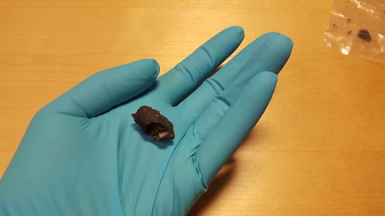 Nicht mehr lecker, aber aufschlussreich: Forscher der Universität Stockholm sind bei der Analyse von rund 10.000 Jahre alten Kaugummis, von denen eines hier untersucht wird, auf menschliche DNA gestoßen.