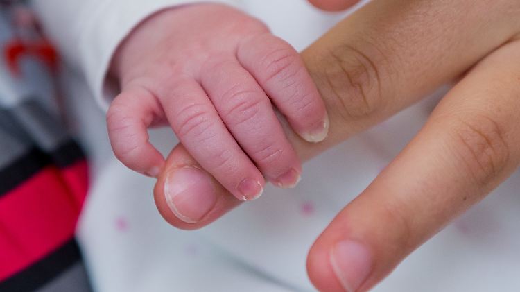Fünf Finger an jeder Hand und fünf Zehen an jedem Fuß: Bei jeder 500. Geburt ist das anders.