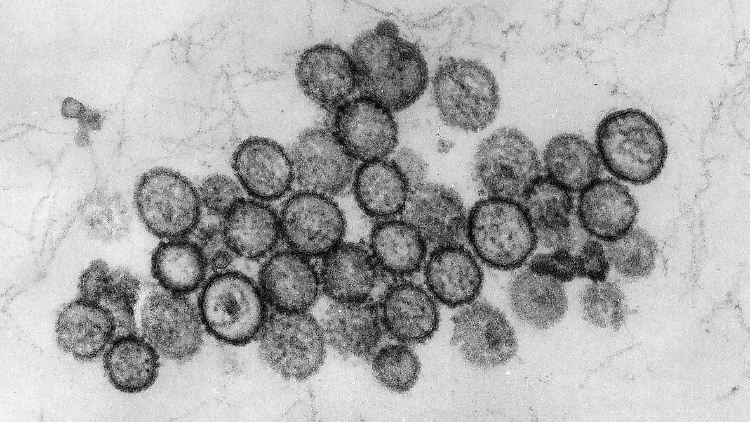 Hierzulande rufen Infektionen mit dem Hantavirus meist Erkrankungen mit grippeähnlichen Symptomen hervor.