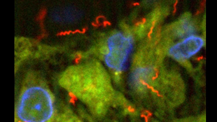 So sieht Treponema pallidum, der Erreger der Syphilis, unter dem Mikroskop aus.