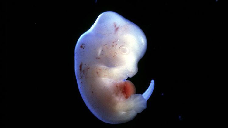 Ein Rattenembryo ohne menschliche Stammzellen.