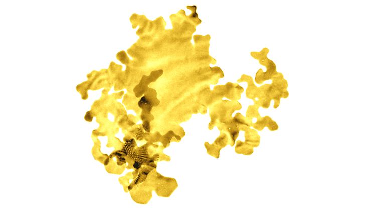 Die entwickelten Goldplättchen können unter anderem in Medizingeräten eingesetzt werden.