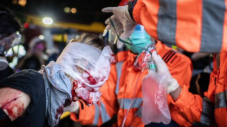 Eine Demonstrantin hat bei Auseinandersetzungen mit der Polizei ein Auge verloren.