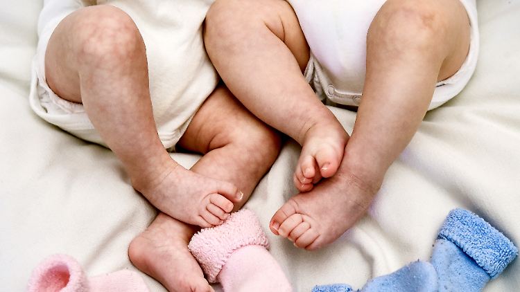 Mindestens 17 Kinder sind von dem starken Haarwuchs betroffen.