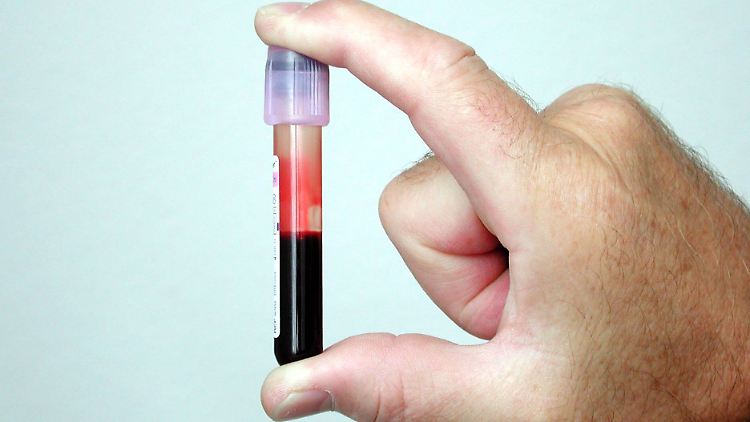 Nicht bei jeder Infektion mit Sars-CoV-2 wandert der Erreger auch ins Blut.