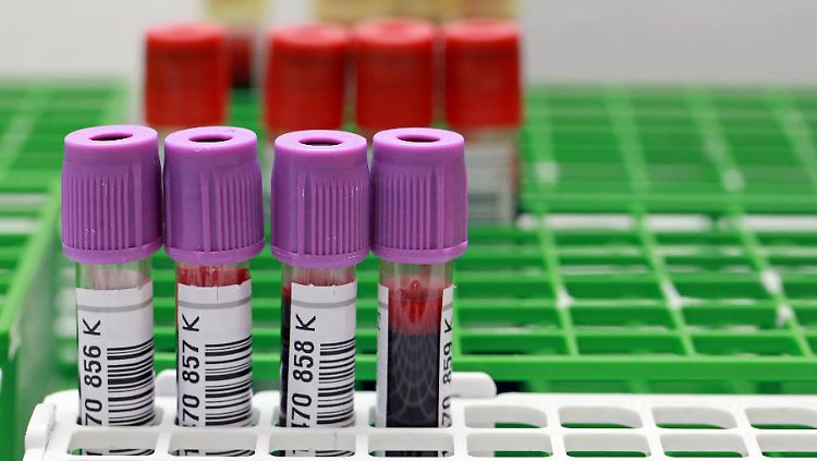 In bestimmten Fällen übernimmt künftig die Kasse die Kosten für einen Trisomie-Test.