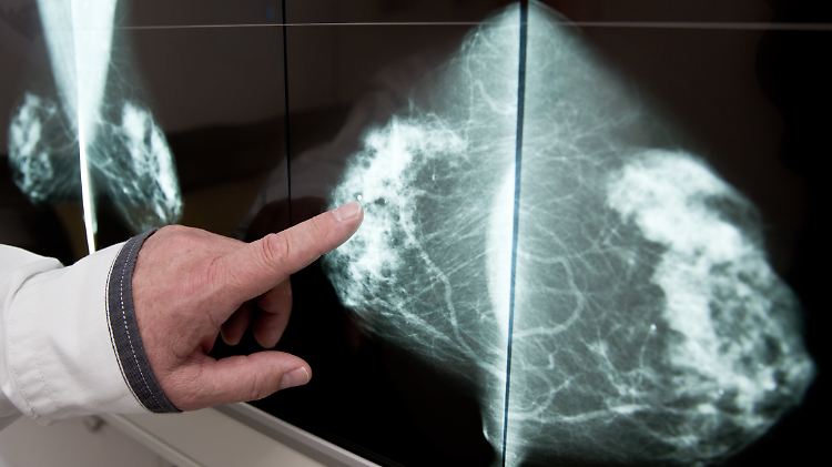 Auch Mammografie-Aufnahmen von Patientinnen sind im Netz gelandet.