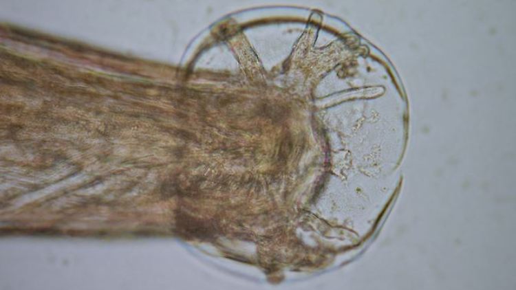 Mikroskopische Aufnahme eines  männlichen Exemplars des Ratten-Lungenwurms.