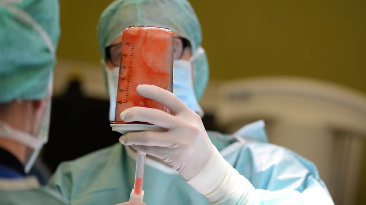 Eine Erprobungsstudie zum Fettabsaugen soll Nutzen und Risiken der Operation deutlich machen.